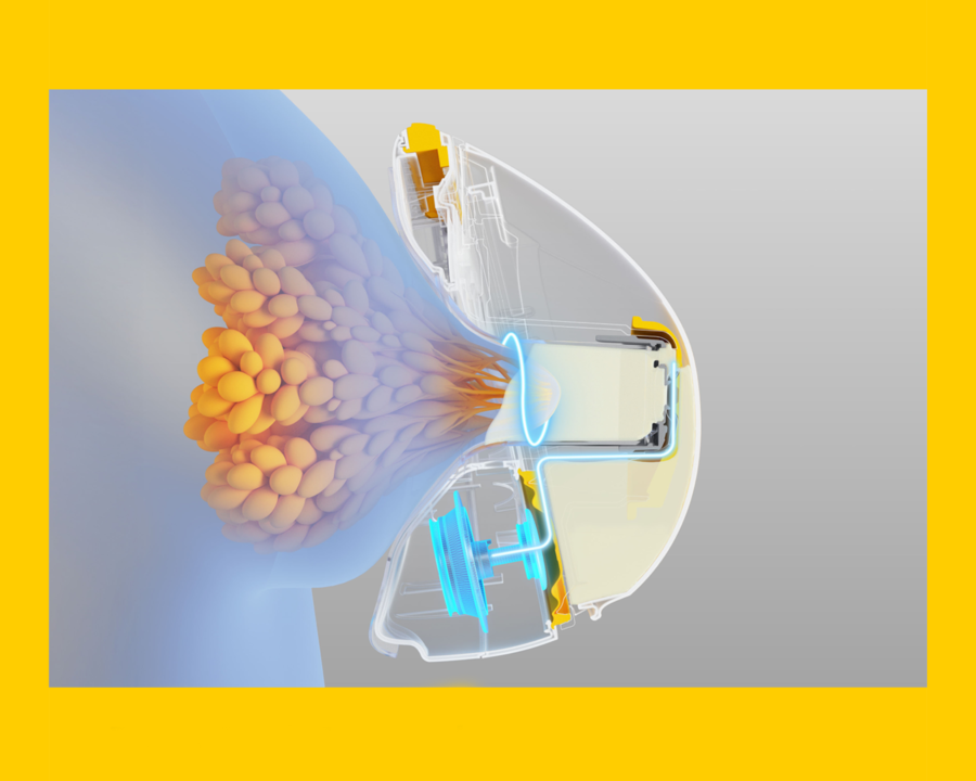 Magic Inbra™, Full Performance, zero compromise