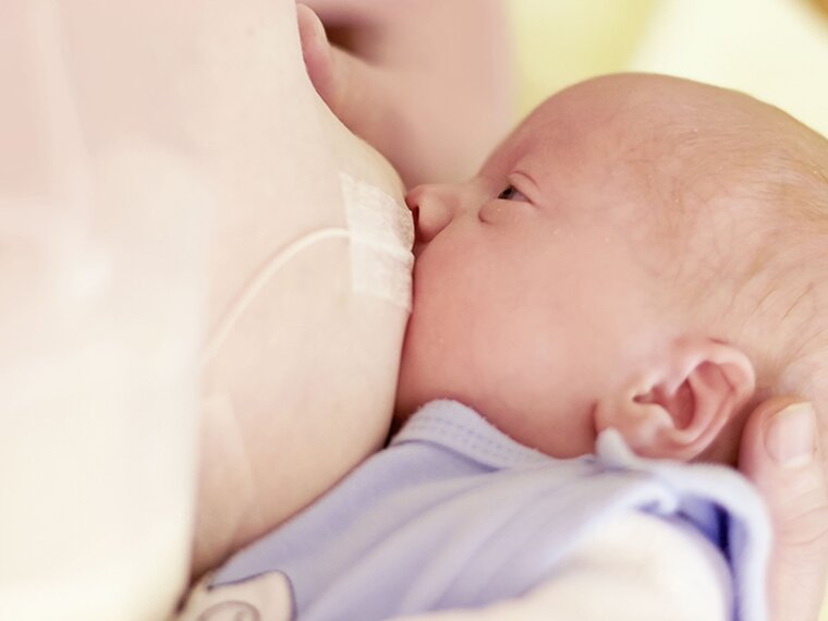 A mom breastfeeding her baby and supplementing the diet using Medela's Supplemental Nursing System™ (SNS).