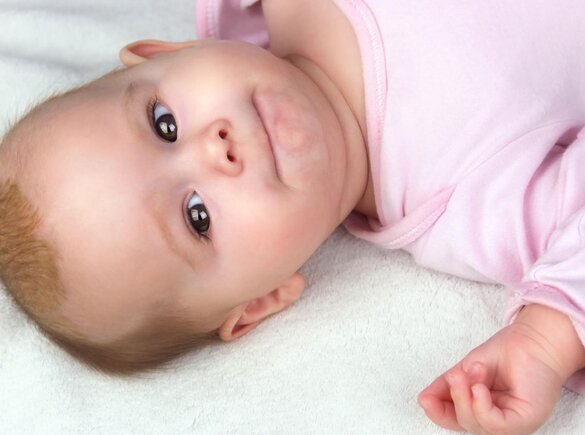 Ein Säugling liegt mit Milchschorf im Bett.