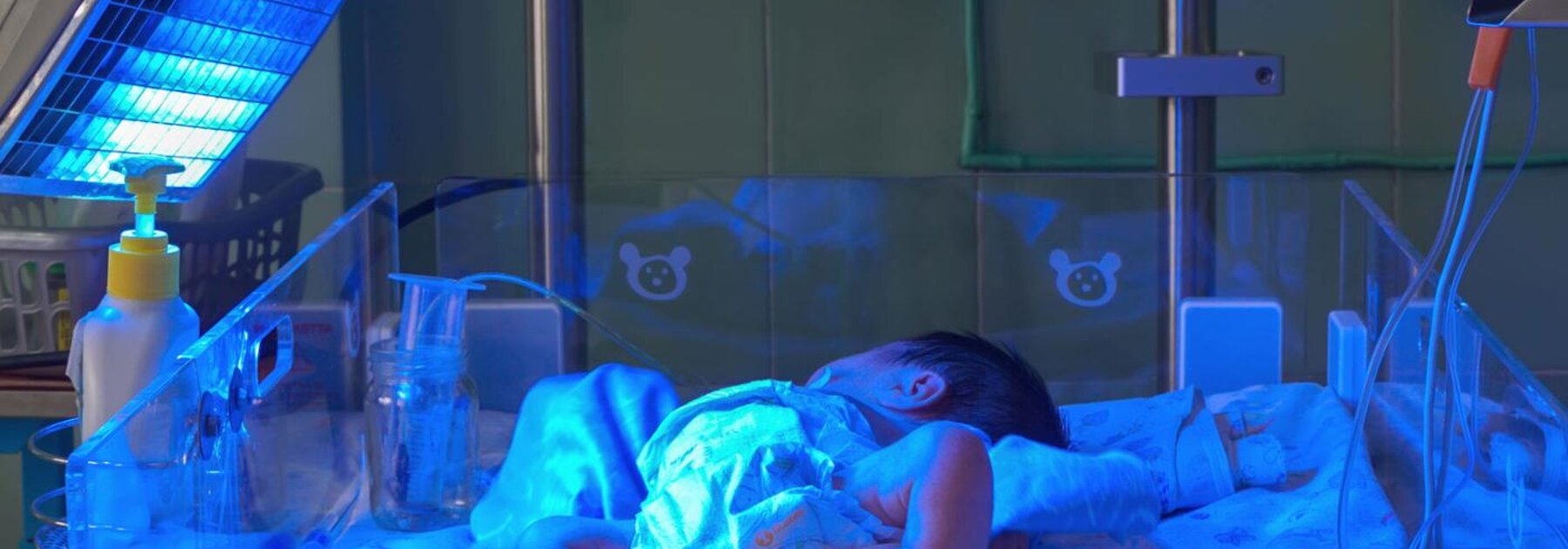 Ein Frühgeborenes unterscheidet sich von einem voll entwickelten Baby