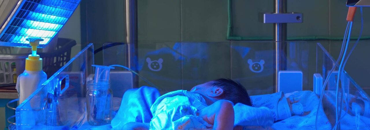 Ein Frühgeborenes unterscheidet sich von einem voll entwickelten Baby