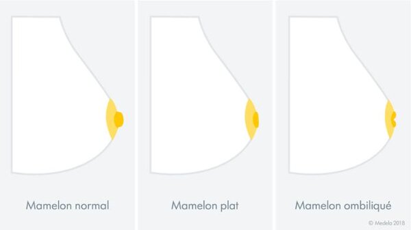 Illustration des types de mamelons