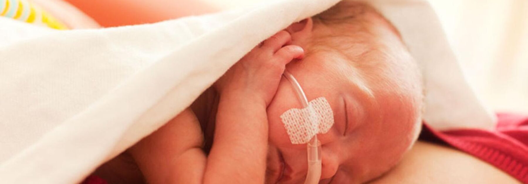 Ein Frühgeborenes liegt auf der Brust der Mutter, um Haut-zu-Haut-Kontakt herzustellen.