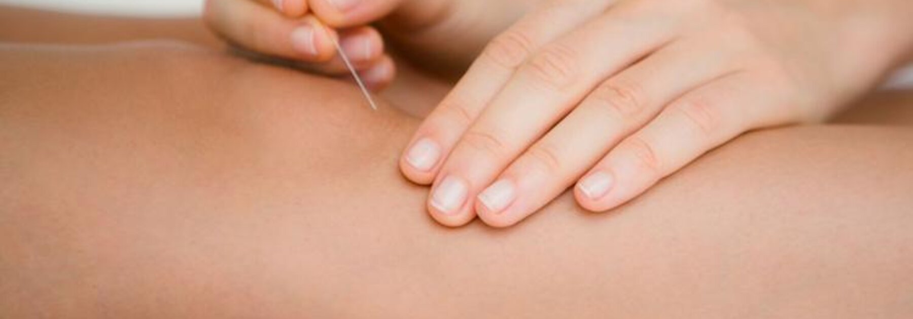 Akupunktur am Knie eines Patienten.