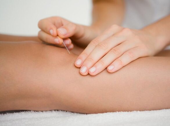 Akupunktur am Knie eines Patienten.