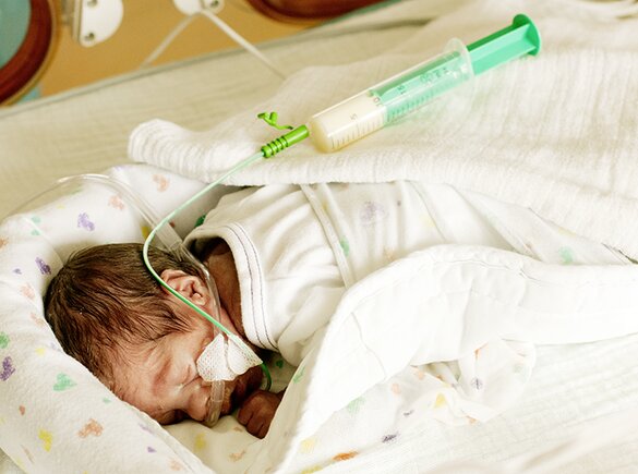A premature baby in the NICU experiencing with feeding challenges.