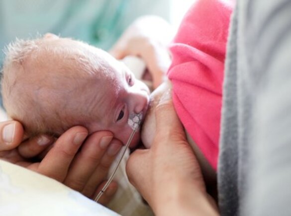 A mother breastfeeds her premature baby.