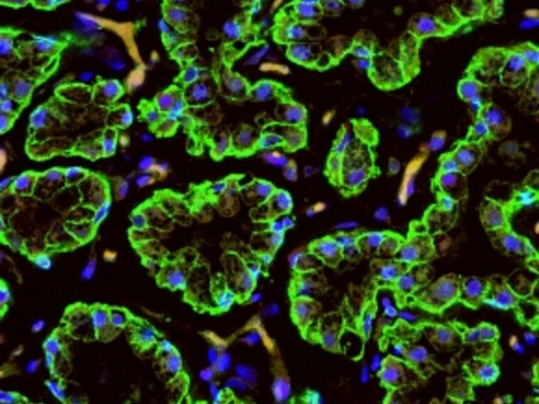 Eine grüne, blaue und schwarze Illustration, die Stammzellen darstellt. Bild aus dem Medela-Artikel „Stammzellen in der Muttermilch“.