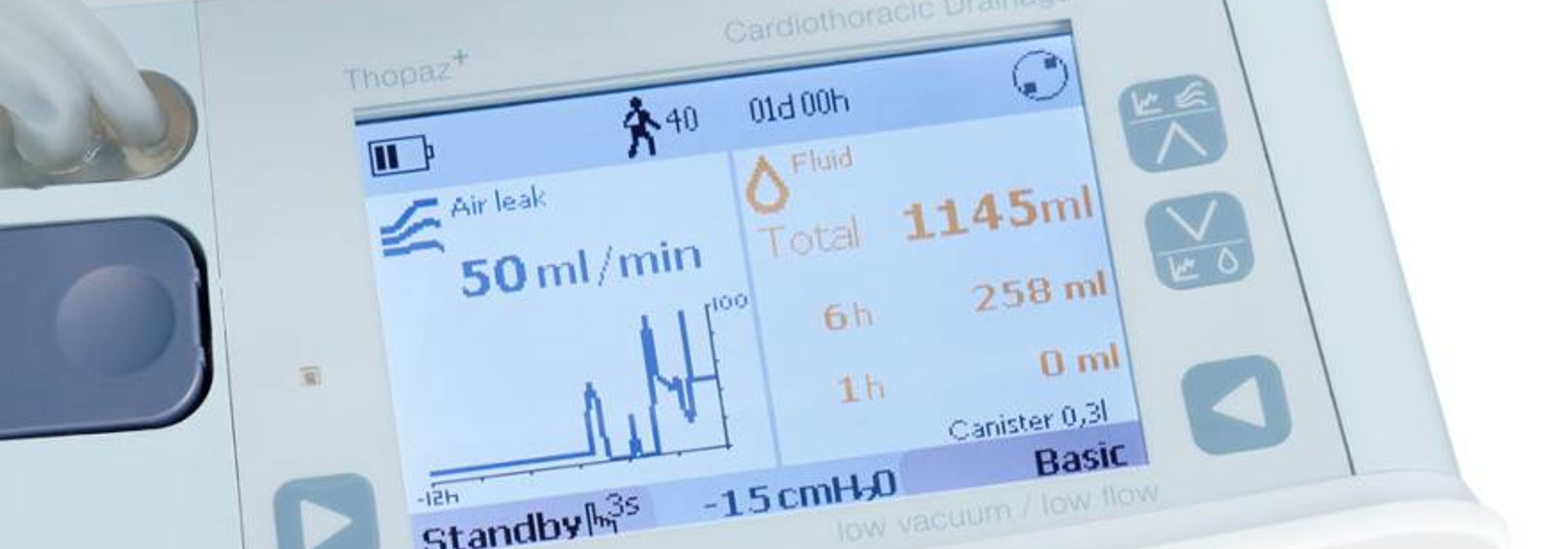 Advancing Patient Recovery with Digital Chest Drainage Systems