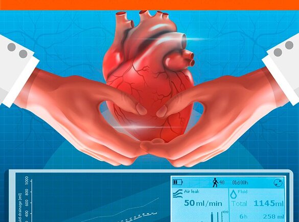 Das Titelblatt des Journal of Cardiac Surgery, das der Praxis der Herzchirurgie bei Erwachsenen und Kindern gewidmet ist, 2020, Band 35, Ausgabe 7.