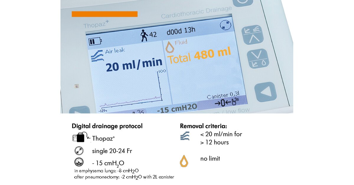 Optimising Minimally Invasive Thoracic Surgery with Thopaz+: