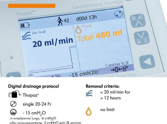 Thopaz⁺ digital chest drainage and monitoring system The digital display of the Medela Thopaz⁺.