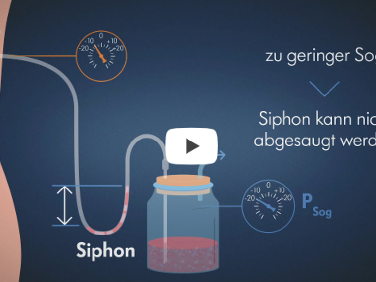 Ein Screenshot aus einem Video über das Management von Thoraxdrainagen.