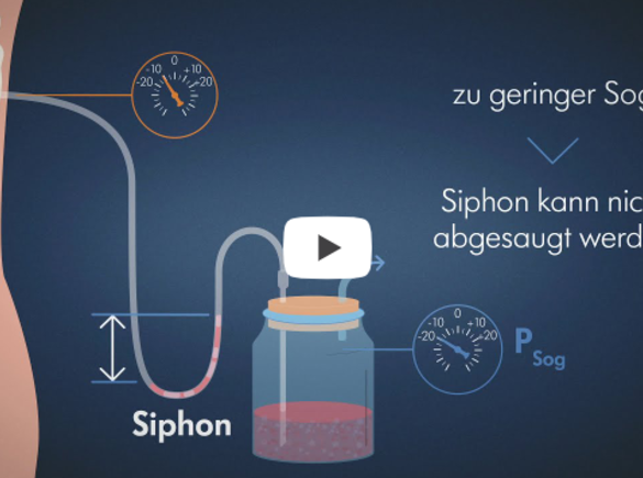 Ein Screenshot aus einem Video über das Management von Thoraxdrainagen.