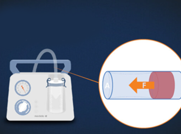 Getekende afbeelding van een Dominant pomp die de vacuümzuigstroom van rechts naar links laat zien.