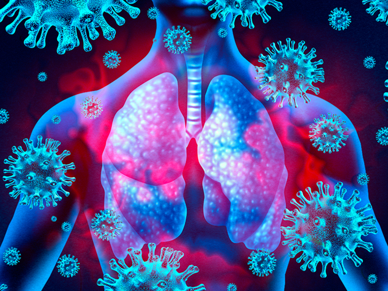An illustration in shades of pink and blue of a human torso with lungs and the coronavirus floating around it.