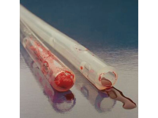 An Axiom® Mediastinal Drain tubing with human fluids draining.