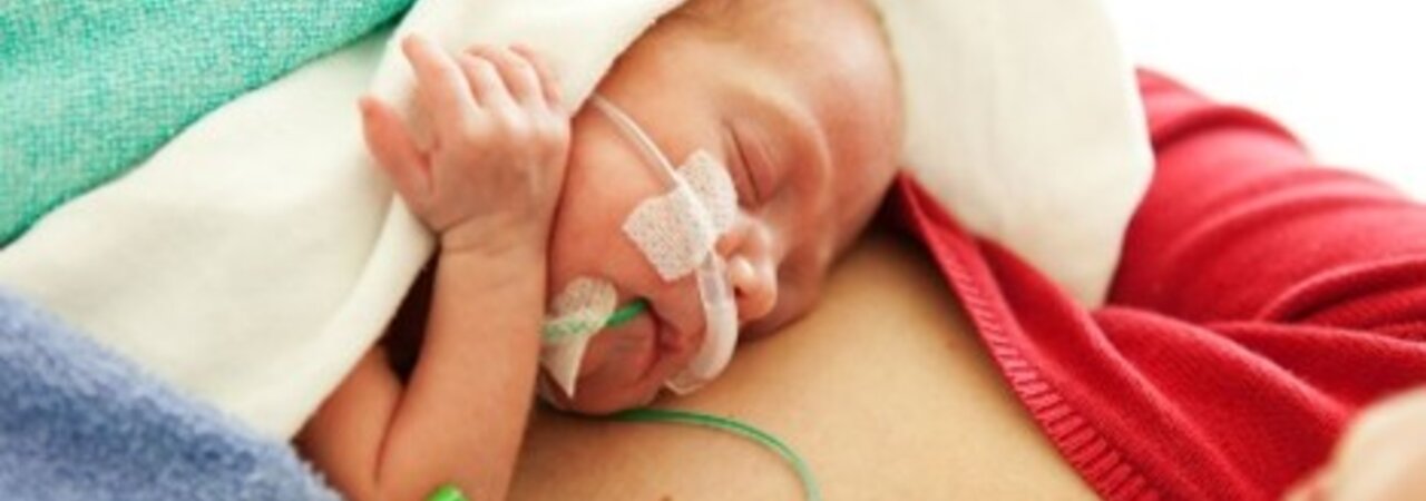 Un neonato con esigenze alimentari particolari riceve una dose di OMM, il proprio latte materno, mentre è sdraiato sul petto della mamma.